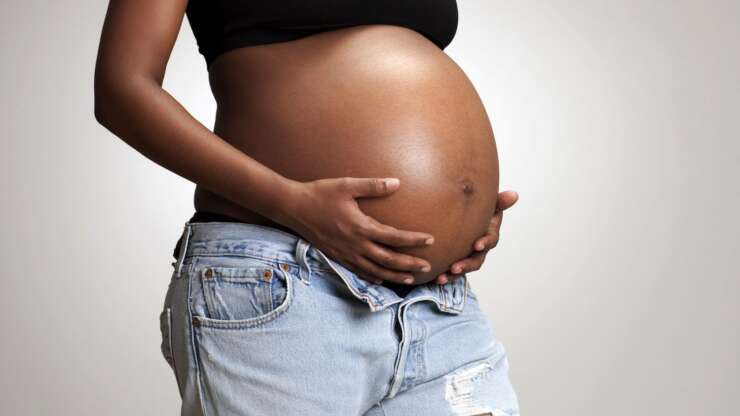 Pregnancy with Ovarian Cysts and Polycystic Ovarian Syndrome.