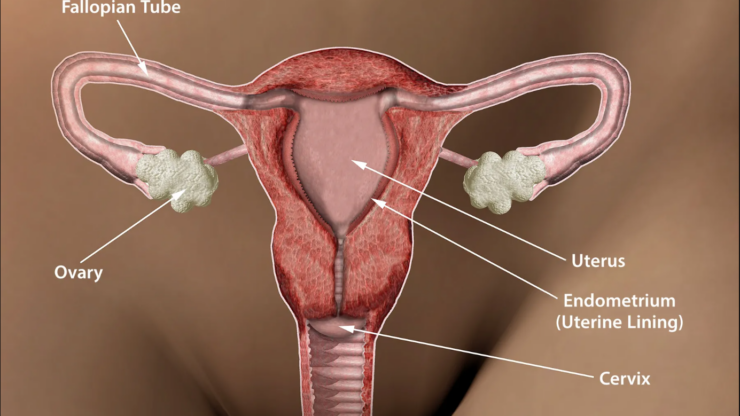 How Pelvic Inflammatory Disease Can Lead to Infertility